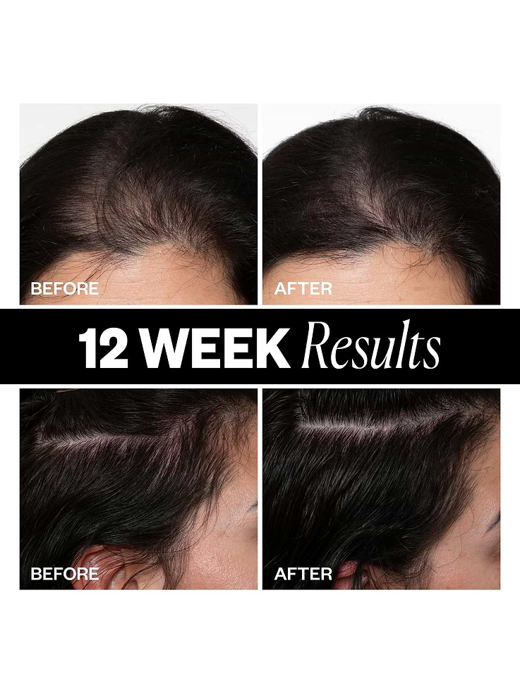Image number 3 showing, IGK Sponsored High Density Scalp Treatment